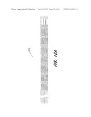 SYSTEM FOR PROVIDING PROGRESSIVE THERAPY FOR THROMBUS MANAGEMENT diagram and image