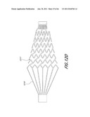 SYSTEM FOR PROVIDING PROGRESSIVE THERAPY FOR THROMBUS MANAGEMENT diagram and image