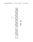 SYSTEM FOR PROVIDING PROGRESSIVE THERAPY FOR THROMBUS MANAGEMENT diagram and image