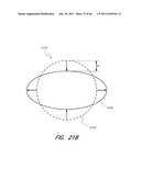 SYSTEM FOR PROVIDING PROGRESSIVE THERAPY FOR THROMBUS MANAGEMENT diagram and image