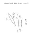 MULTIPLE LAYER EMBOLUS REMOVAL diagram and image