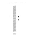 MULTIPLE LAYER EMBOLUS REMOVAL diagram and image