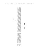 MULTIPLE LAYER EMBOLUS REMOVAL diagram and image