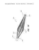 MULTIPLE LAYER EMBOLUS REMOVAL diagram and image