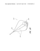 MULTIPLE LAYER EMBOLUS REMOVAL diagram and image