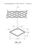 MULTIPLE LAYER EMBOLUS REMOVAL diagram and image