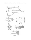 APPARATUS AND METHODS FOR REDUCING EMBOLIZATION DURING TREATMENT OF     CAROTID ARTERY DISEASE diagram and image