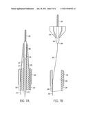 APPARATUS AND METHODS FOR REDUCING EMBOLIZATION DURING TREATMENT OF     CAROTID ARTERY DISEASE diagram and image