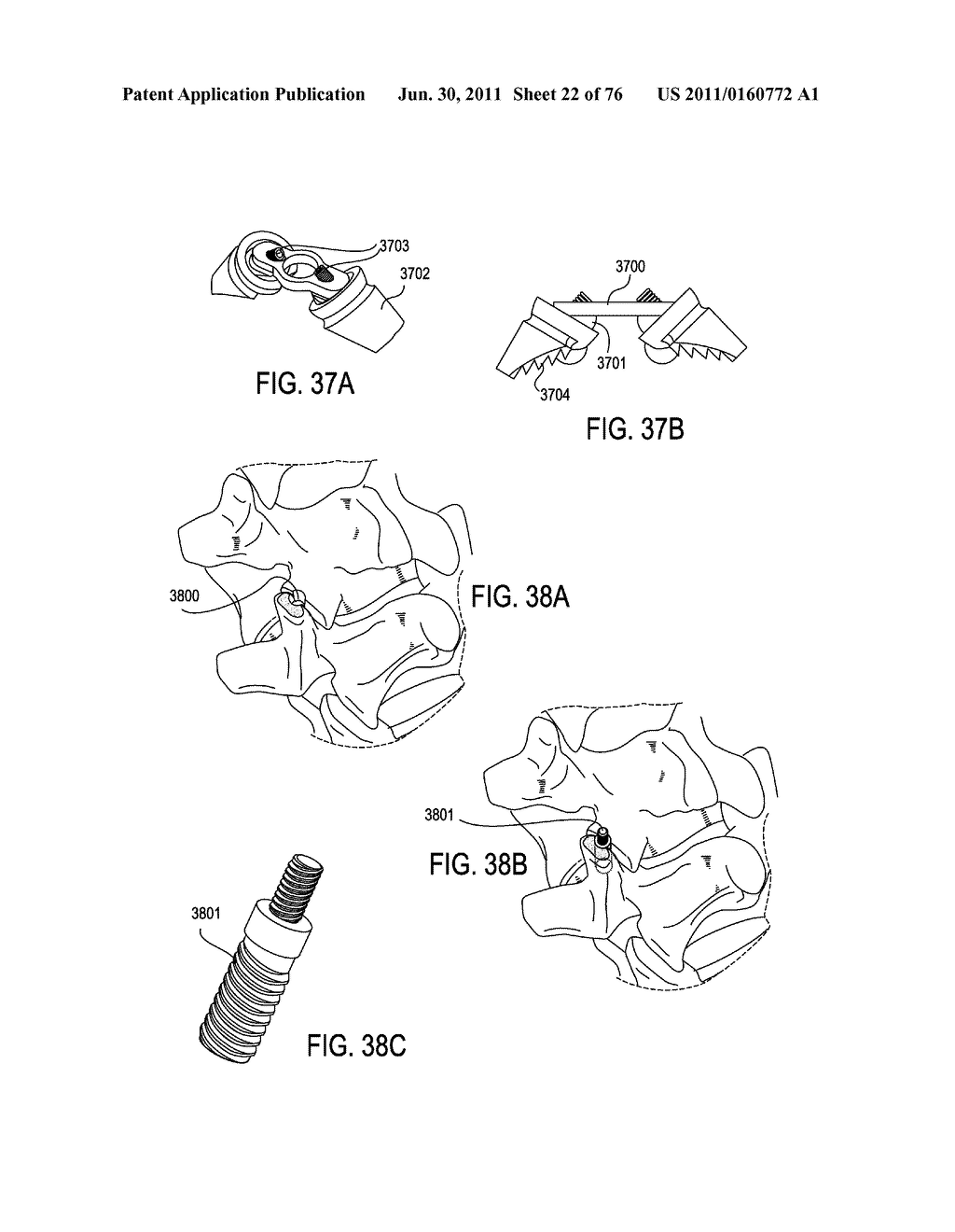 SYSTEMS AND METHODS FOR PERFORMING SPINAL FUSION - diagram, schematic, and image 23