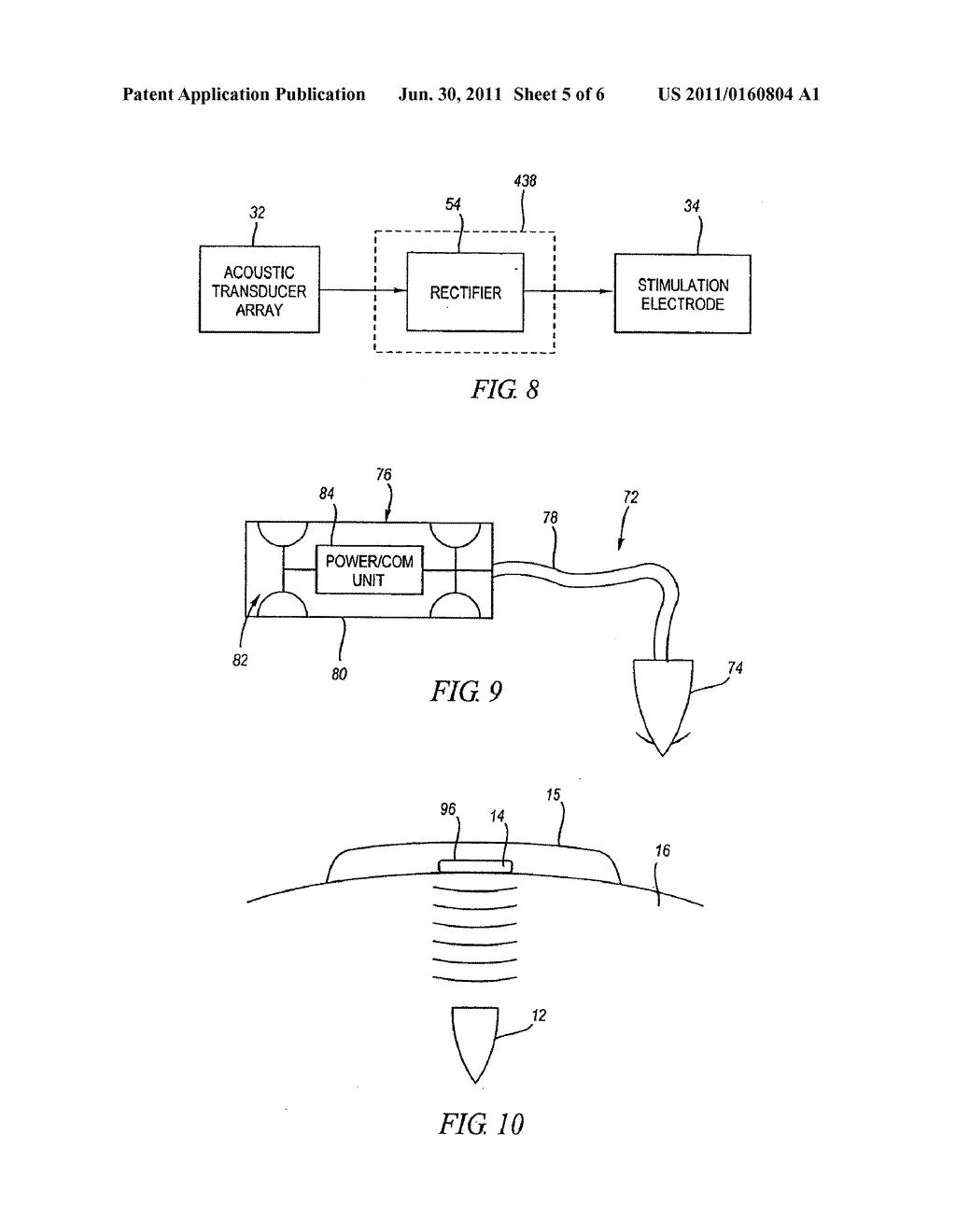 ACOUSTICALLY POWERED IMPLANTABLE STIMULATING DEVICE - diagram, schematic, and image 06
