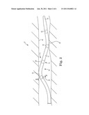 ELECTRODE SURFACE MODIFICATION FOR IMPARTING CURRENT DENSITY     DIRECTIONALITY IN LEAD ELECTRODES diagram and image