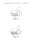 ELECTRODE SURFACE MODIFICATION FOR IMPARTING CURRENT DENSITY     DIRECTIONALITY IN LEAD ELECTRODES diagram and image