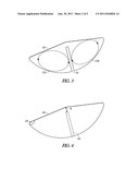 IMPLANTABLE MEDICAL DEVICE INCLUDING EDDY CURRENT REDUCING CAPACITOR diagram and image