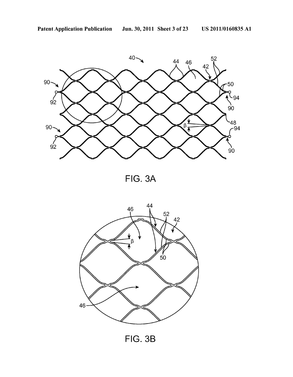 INDIRECT-RELEASE ELECTROLYTIC IMPLANT DELIVERY SYSTEMS - diagram, schematic, and image 04