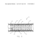 INTRAVASCULAR DEVICE ATTACHMENT SYSTEM HAVING BIOLOGICAL MATERIAL diagram and image