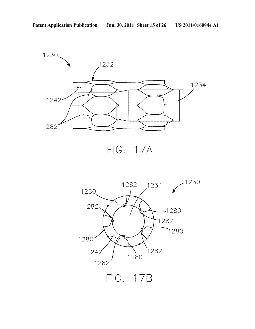 INTRAVASCULAR DEVICE ATTACHMENT SYSTEM HAVING BIOLOGICAL MATERIAL - diagram, schematic, and image 16