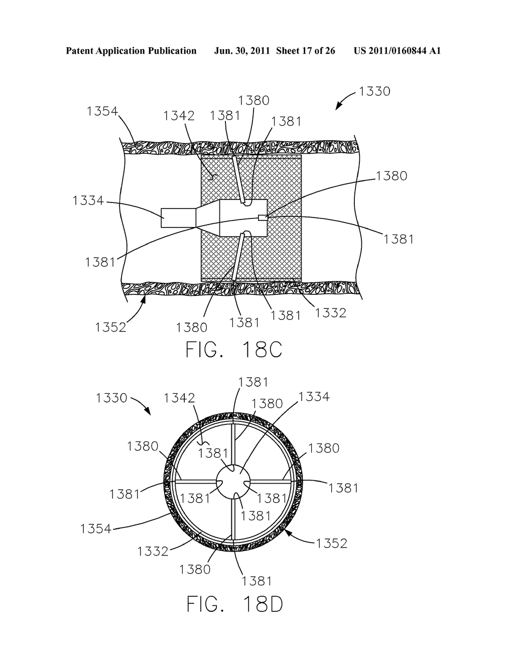 INTRAVASCULAR DEVICE ATTACHMENT SYSTEM HAVING BIOLOGICAL MATERIAL - diagram, schematic, and image 18
