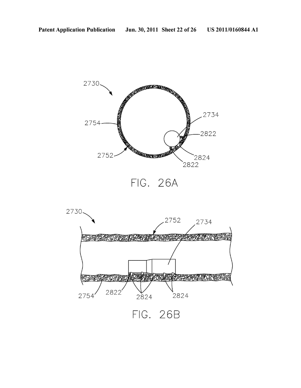 INTRAVASCULAR DEVICE ATTACHMENT SYSTEM HAVING BIOLOGICAL MATERIAL - diagram, schematic, and image 23