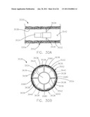 INTRAVASCULAR DEVICE ATTACHMENT SYSTEM HAVING BIOLOGICAL MATERIAL diagram and image