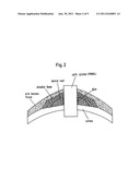 Keratoprosthesis diagram and image