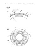 Keratoprosthesis diagram and image