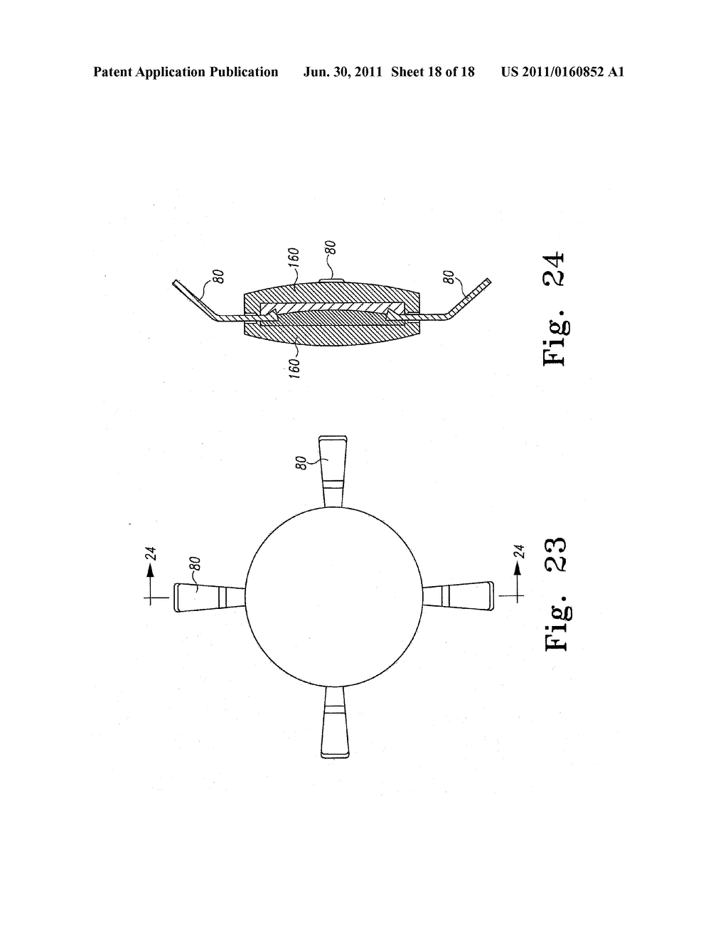 INTERFACIAL REFRACTION ACCOMMODATING LENS (IRAL) - diagram, schematic, and image 19