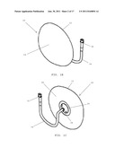 BREAST IMPLANTS HAVING DRUG-ELUTING RESERVOIRS AND METHODS THEREFOR diagram and image