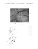 BREAST IMPLANTS HAVING DRUG-ELUTING RESERVOIRS AND METHODS THEREFOR diagram and image