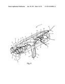 Systems and Methods for Zipknot ACL Fixation diagram and image