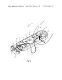 Systems and Methods for Zipknot ACL Fixation diagram and image