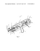 Systems and Methods for Zipknot ACL Fixation diagram and image