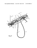 Systems and Methods for Zipknot ACL Fixation diagram and image