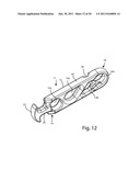 Systems and Methods for Zipknot ACL Fixation diagram and image