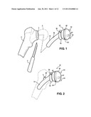 COMBINATION MALE/FEMALE HIP JOINT AND INSTALLATION KIT diagram and image