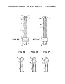 COMBINATION MALE/FEMALE HIP JOINT AND INSTALLATION KIT diagram and image