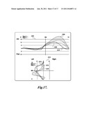 SELF-ALIGNING PROSTHESIS WITH HYDRAULIC ACTUATORS diagram and image