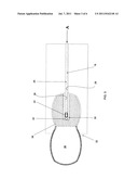 ENCASEMENT FOR A MATTRESS diagram and image