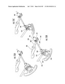 HOSPITAL BED diagram and image