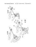 HOSPITAL BED diagram and image