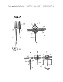 FIXING TIE diagram and image