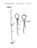 FIXING TIE diagram and image