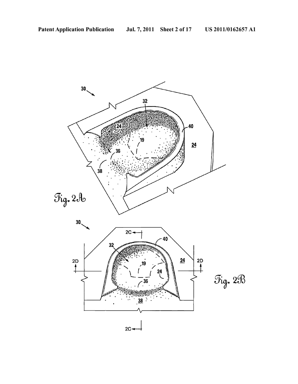 Mattress Incorporating a Headrest for Preventing and Correcting     Non-Synostotic Cranial Deformities in Infants - diagram, schematic, and image 03