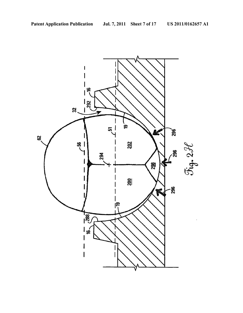 Mattress Incorporating a Headrest for Preventing and Correcting     Non-Synostotic Cranial Deformities in Infants - diagram, schematic, and image 08