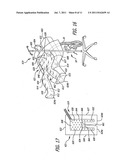 Surgical barrier device incorporating an inflatable thermal blanket with     an attached surgical drape diagram and image