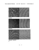 ALEXIPHARMIC CIGARETTE FILTER MATERIAL AND THEIR PRAPARATION diagram and image