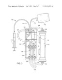 Dialysis Systems and Methods diagram and image