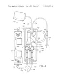 Dialysis Systems and Methods diagram and image