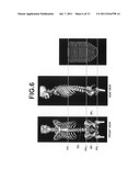 APPARATUS, METHOD, AND PROGRAM FOR DETECTING THREE DIMENMSIONAL ABDOMINAL     CAVITY REGIONS diagram and image