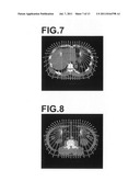 APPARATUS, METHOD, AND PROGRAM FOR DETECTING THREE DIMENMSIONAL ABDOMINAL     CAVITY REGIONS diagram and image