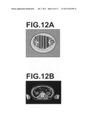 APPARATUS, METHOD, AND PROGRAM FOR DETECTING THREE DIMENMSIONAL ABDOMINAL     CAVITY REGIONS diagram and image